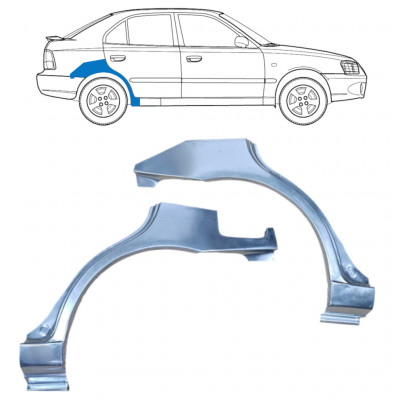 Panneau de réparation arc d'aile arrière pour Hyundai Accent 2000-2006 / Gauche+Droit / Ensemble 9881